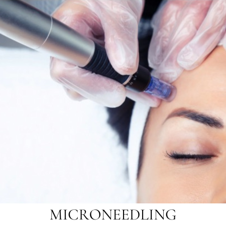 Microneedling Skin Care Service